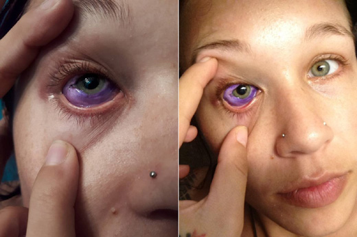 model left crying purple tears after eyeball tattoo goes wrong model left crying purple tears after eyeball tattoo goes wrong