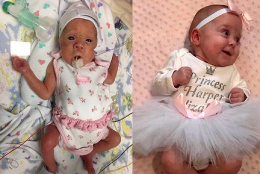 three months premature