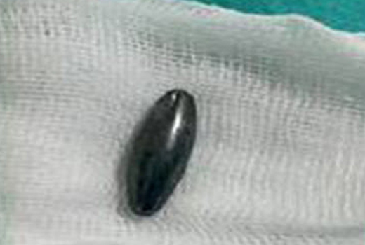 magnet
