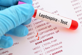 Leptospirosis.j