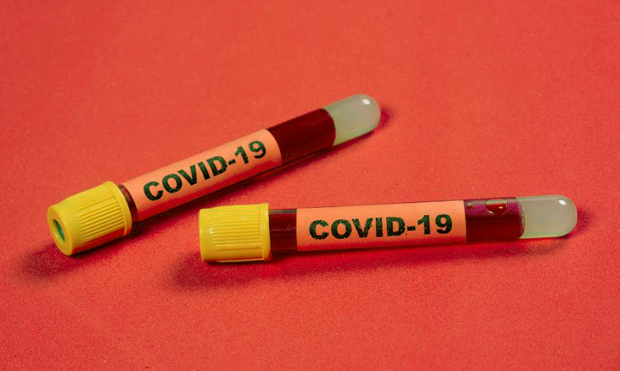 covid-test-1