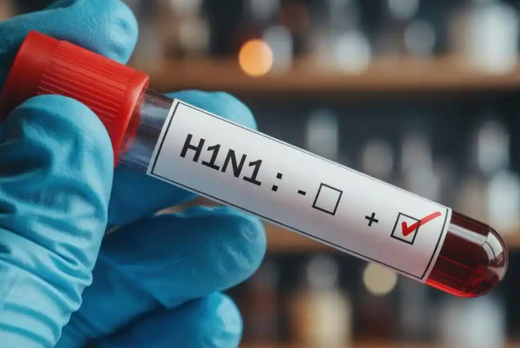 swine flu