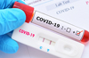 Scientists develop new coronavirus antibody test that gives results in 20 minutes