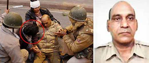 Delhi cop-Cause of Deth