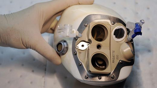 artificial-heart