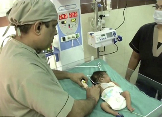 Baby born with THREE arms due to one in a million