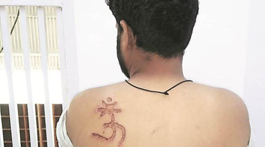 om20