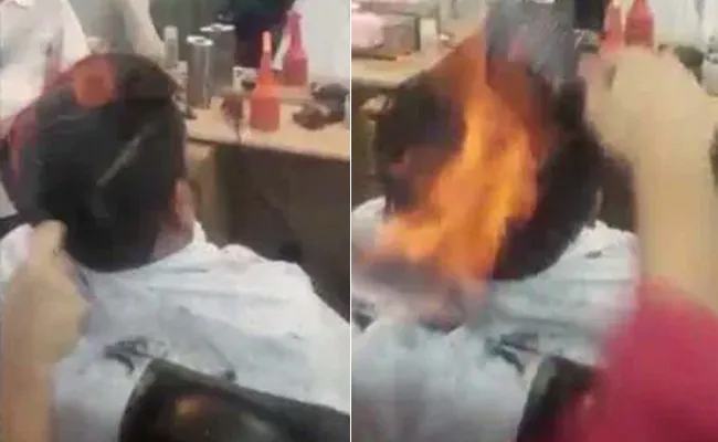 Mangalore Today | Latest headlines of mangalore, udupi - Page  Gujarat-man-suffers-severe-burns-after-Fire-Haircut-goes-horribly-wrong