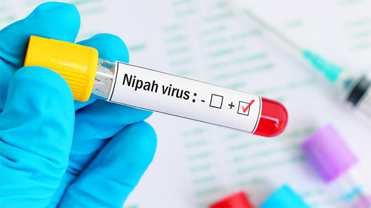 Nipha 