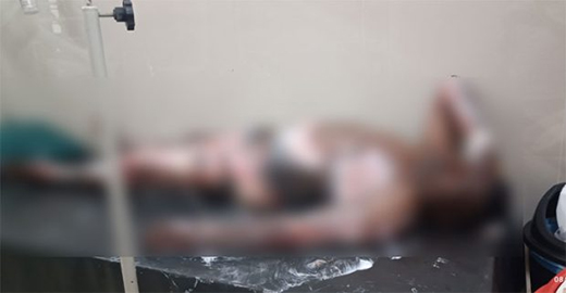 Man Sets Brother on Fire in Kadaba