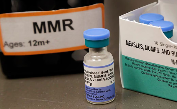 Mumps