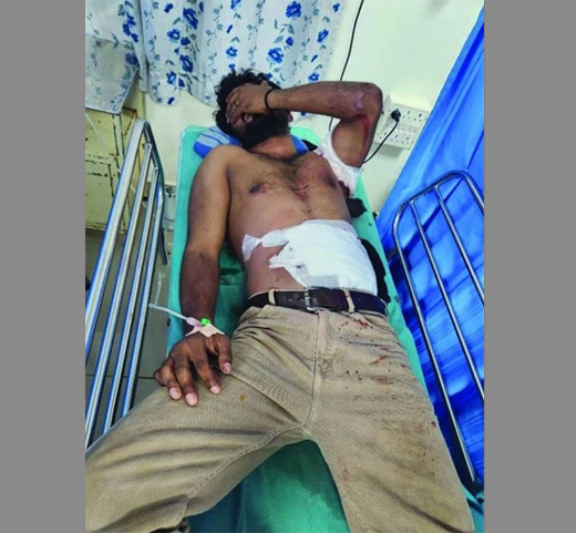 Kana atempt murder victim