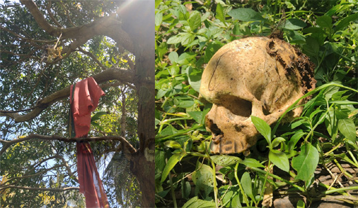 Skeleton
