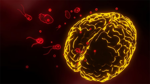 Amoebic meningoencephalitis