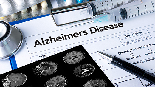 Alzheimer