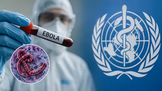 Ebola Virus Disease 