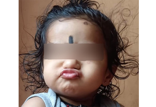 Toddler