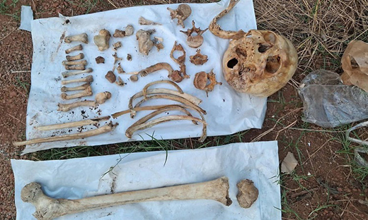 Skull