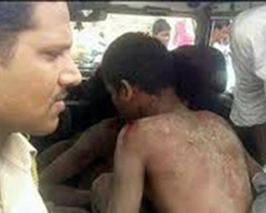 stripped-blore...