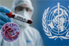 Ebola alert: Karnataka orders statewide vigil across hospitals
