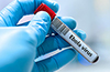 Karnataka Designates Isolation, Quarantine Facilities in Mangaluru, Bengaluru Amid Ebola Alert