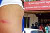 BJP worker narrowly escapes attempt on life near Konaje