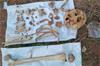Udupi: Human skull and skeletal remains found in Ananth Nagar, police launch probe