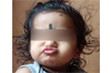 Brahmavar: Toddler dies after coconut falls on him near home