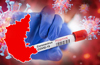 Karnataka reports 380 new Covid cases, 8 fatalities