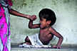 Govt must provide special benefits to Endosulfan vicitms: Association