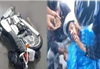 Biker seriously injured after skidding on NH-66 in Kundapur