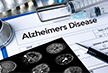 Indian scientists develop smartphone-based technology for affordable Alzheimer’s diagnosis