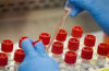 UK virus strain in India: 14 more test positive, 20 cases so far