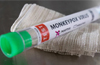 Health Ministry releases Dos and Don’ts to prevent spread of Monkeypox