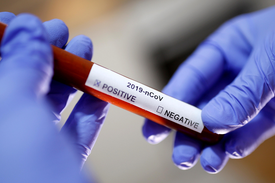 New Medical device can neutralise Coronavirus, will be sent to US to test: Bengaluru Scientist