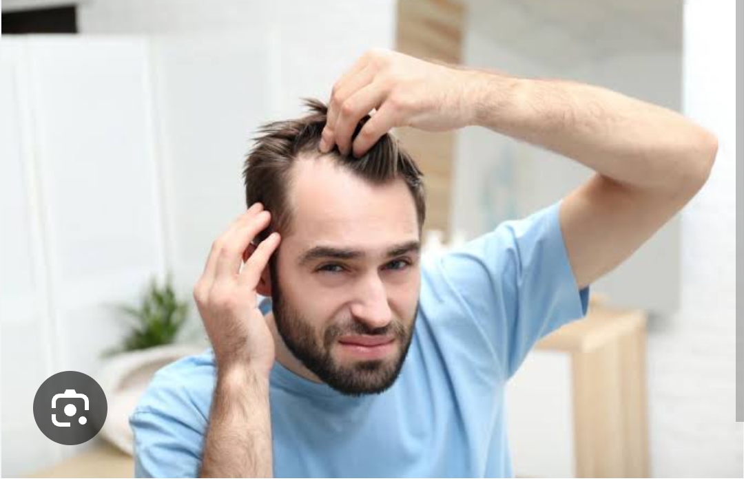 Topical Finasteride for Hair Loss and Thicker Hair