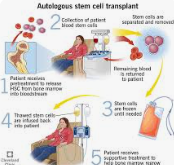 Stem Cell Therapy and the Future of Regenerative Medicine