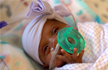 Worlds tiniest surviving baby born in California