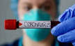 Indias Covid count crosses 81 Lakh with 48,000 new cases