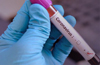 1,52,879 fresh Coronavirus cases in India in biggest-ever one-day spike