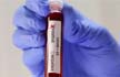 Indias novel coronavirus tally crossed the 22-lakh mark