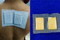 Gold worth Rs 7.5 lakh hidden in bandage ceased at Chennai airport
