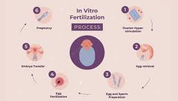 IVF Treatment Comprehensive Guide