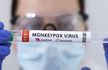 Suspected monkeypox case in Karnataka