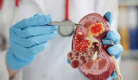 Nephrology and Advanced Care