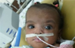 Bengaluru doctors perform rare surgery to separate conjoined twins from Mauritius