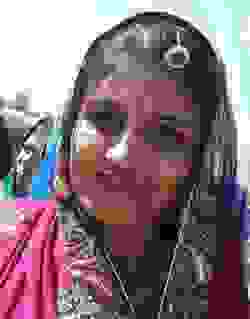 VAISHALI_Anest